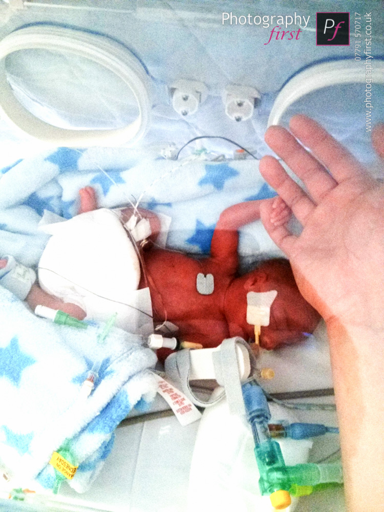 Premature Baby (5)